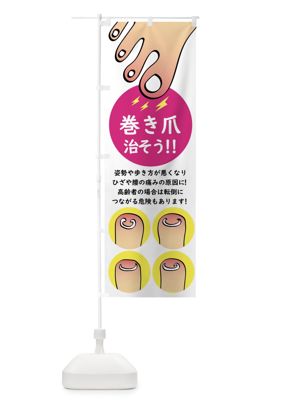 のぼり 巻き爪矯正 のぼり旗 XLT9(デザイン【A】)