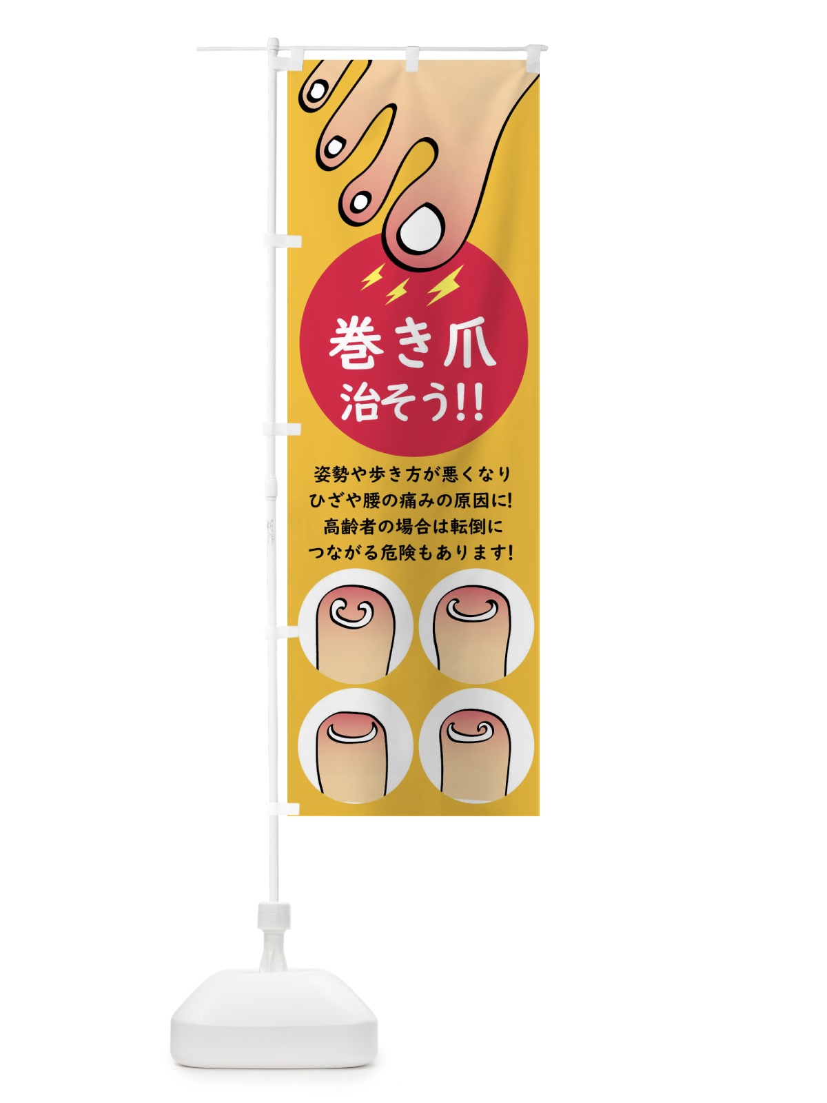 のぼり 巻き爪矯正 のぼり旗 XLT9(デザイン【B】)