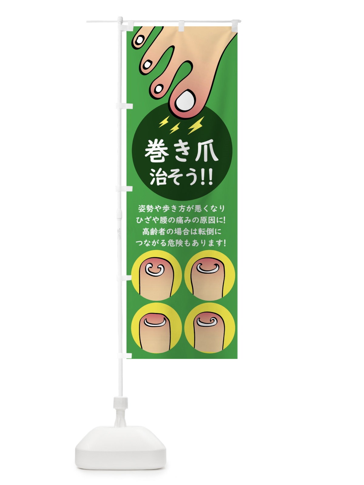 のぼり 巻き爪矯正 のぼり旗 XLT9(デザイン【C】)