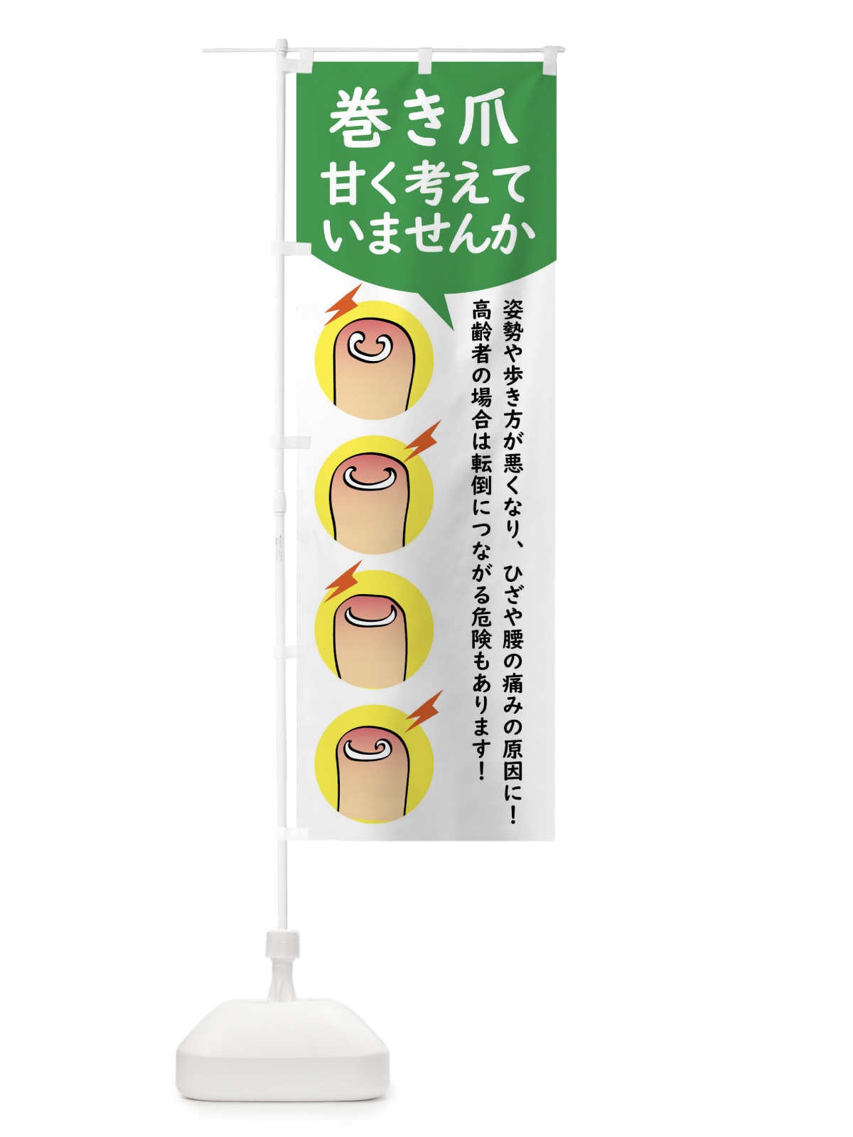 のぼり 巻き爪矯正 のぼり旗 XLTL(デザイン【A】)