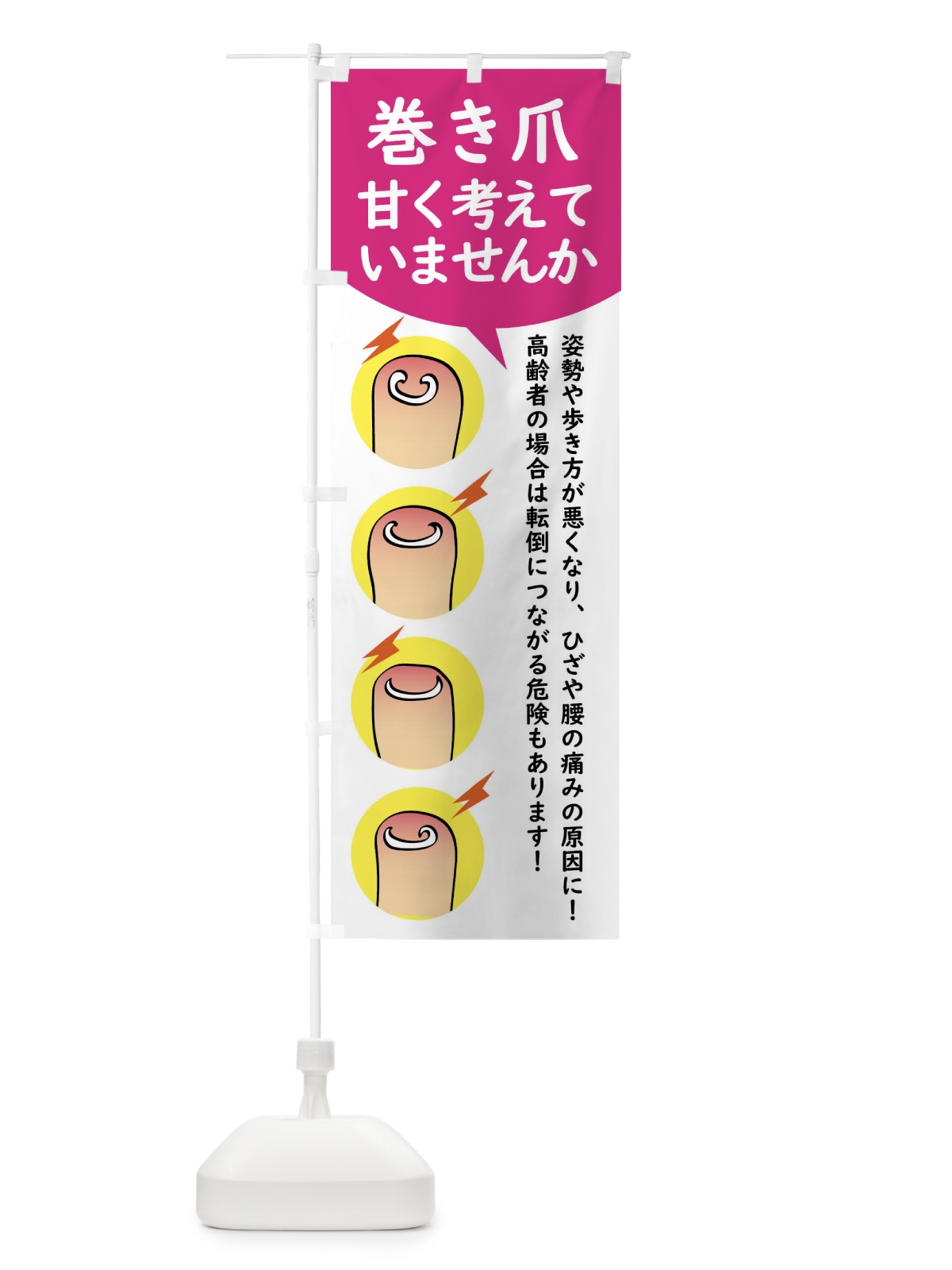 のぼり 巻き爪矯正 のぼり旗 XLTL(デザイン【B】)