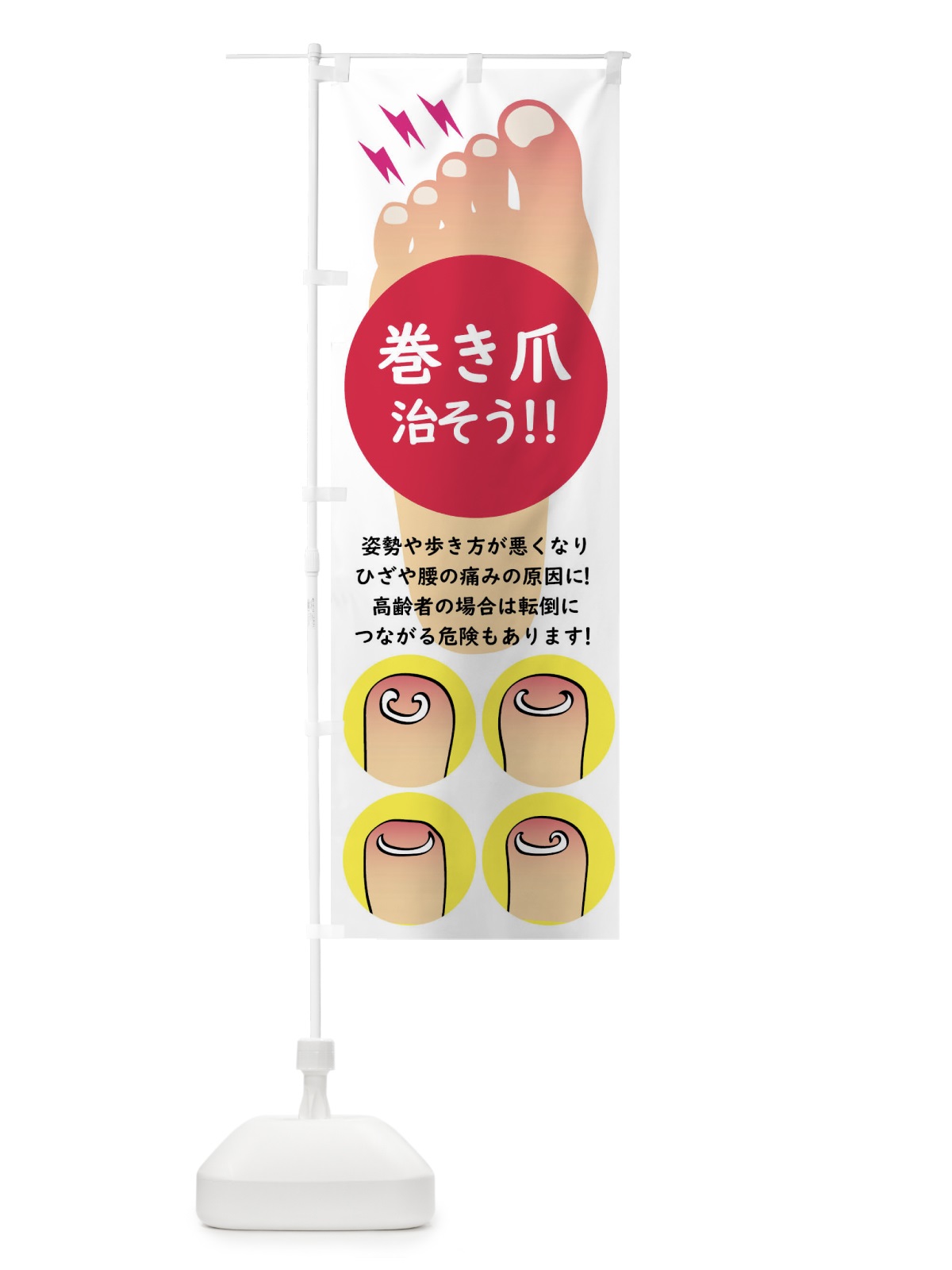 のぼり 巻き爪矯正 のぼり旗 XLXN(デザイン【A】)