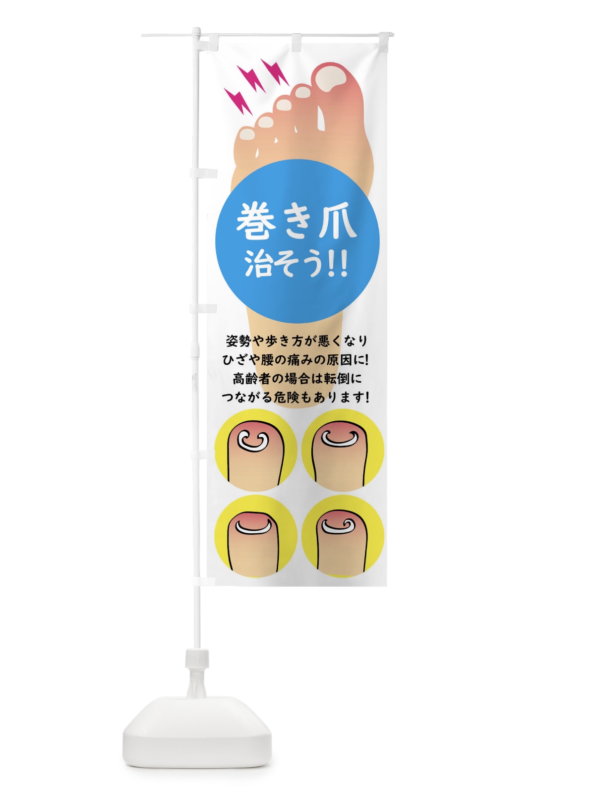 のぼり 巻き爪矯正 のぼり旗 XLXN(デザイン【B】)