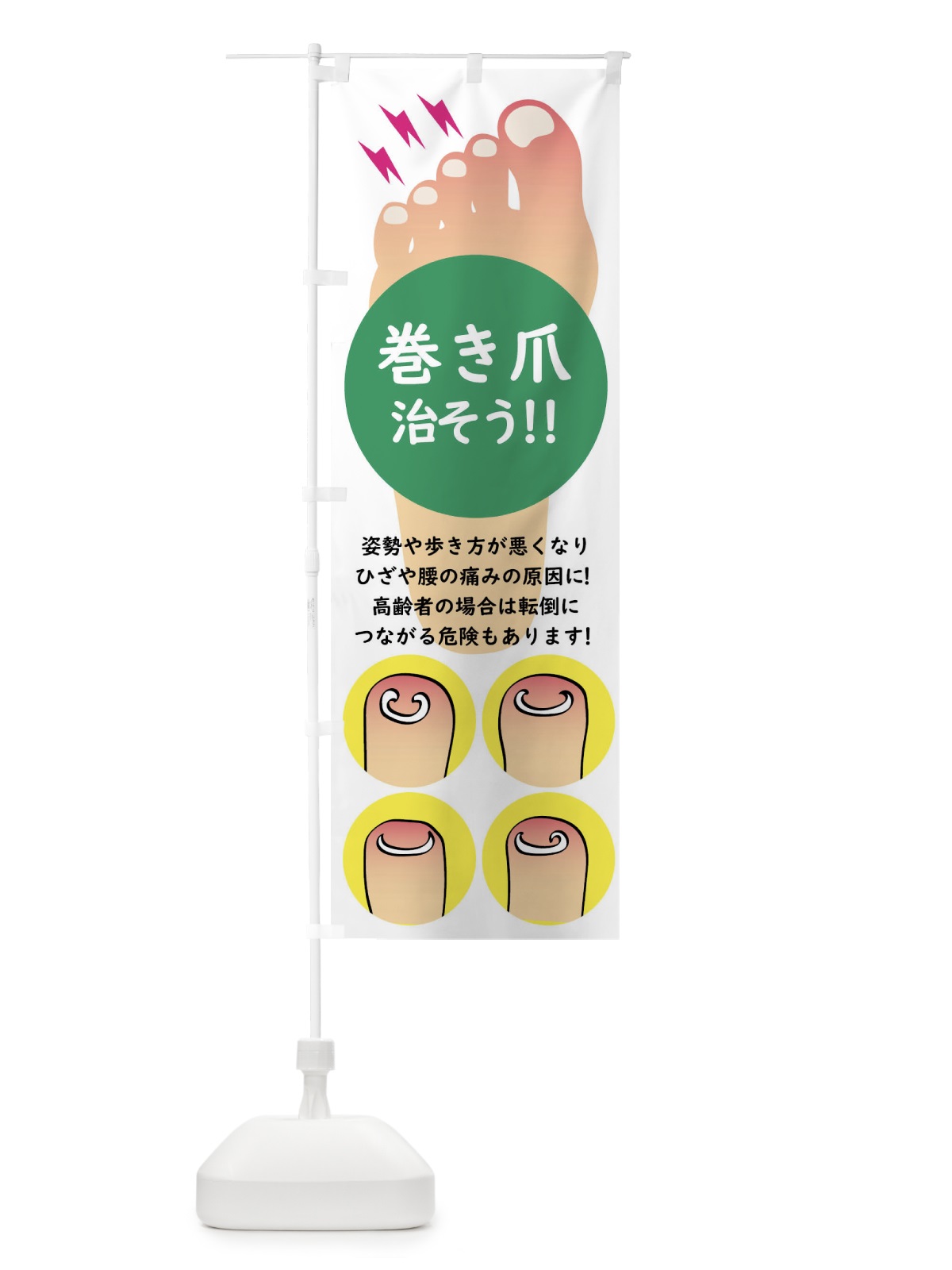 のぼり 巻き爪矯正 のぼり旗 XLXN(デザイン【C】)